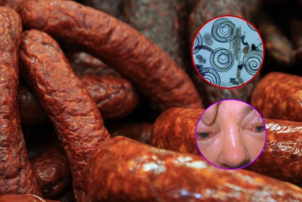 Trihineloza - Bolje spriječiti nego liječiti!