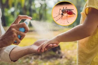 Prirodni lijek koji smanjuje svrab nakon uboda komarca