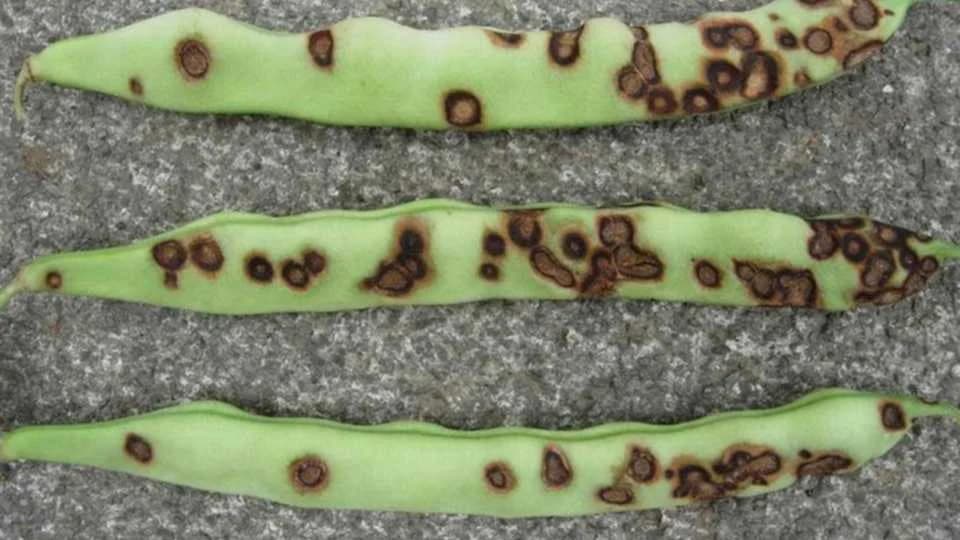 ANTRAKNOZA: Najopasnija bolest pasulja i boranije