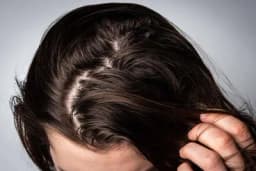 Uz pomoć sastojaka iz kuhinje, uklonite neželjenu farbu sa kose