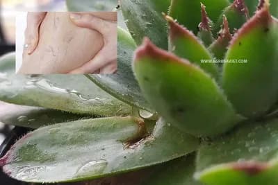 Evo kako da se na prirodan način riješite ispucalih kapilara na nogama i licu