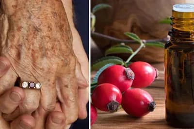 Ulje od šipka - Protiv staračkih fleka ail i za jači imunitet