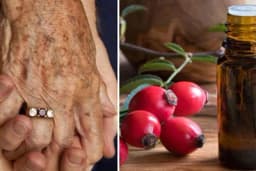 Ulje od šipka - Protiv staračkih fleka ail i za jači imunitet